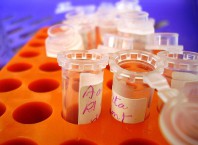 Резус фактор негативный у матери: которые могут быть осложнение? Резус фактор негативный у матери: которые могут быть осложнение?