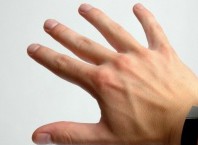 Как вылечить выбитый палец быстро?